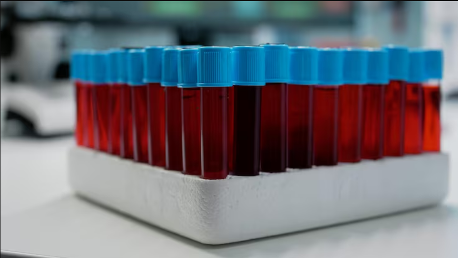 Blood sample vials ready for pathology testing at Pathocity lab